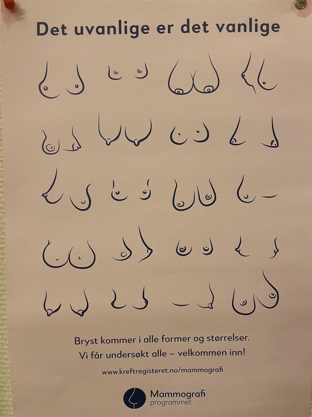 Illustrasjon som viser bryst i ulike former. - Klikk for stort bilde